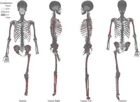 A complete distribution map of the traumatic injuries found on Tsukumo No. 24